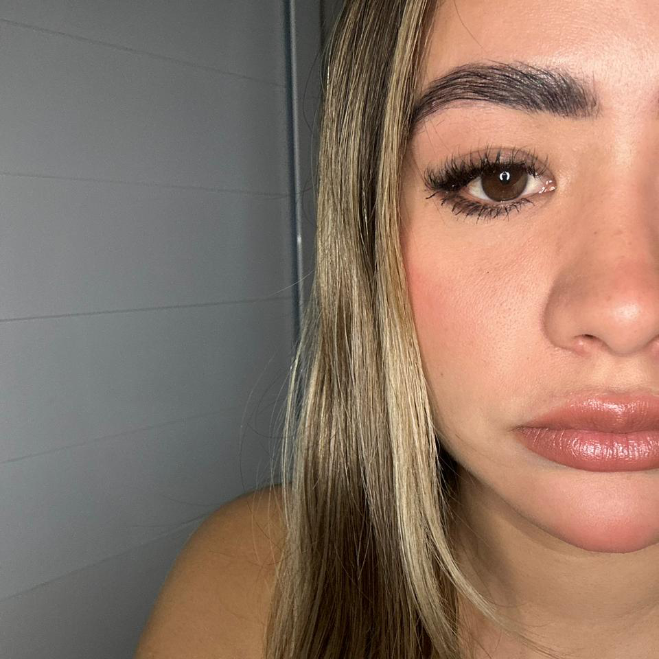 Antes